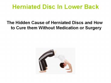 Herniated Disc in Lower Back