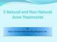 5 Natural and Non-Natural Acne Treatments PowerPoint PPT Presentation