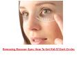 Hydrolyze Eye Cream PowerPoint PPT Presentation