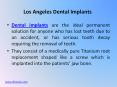 Los Angeles Dental Implants