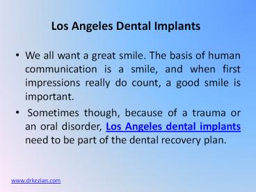 Los Angeles Dental Implants