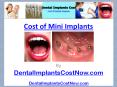 Cost Of Mini Implants PowerPoint PPT Presentation