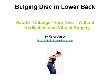 Bulging Disc in Lower Back Natural Treatments