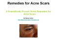 4 Scientifically Proven Home Remedies for Acne Scars PowerPoint PPT Presentation