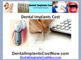 [Dental Implants Cost] PowerPoint PPT Presentation