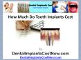 How Much Do Tooth Implants Cost PowerPoint PPT Presentation