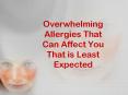 Overwhelming Allergies That Can Affect You That is Least Expected PowerPoint PPT Presentation