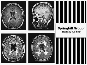 Springhill Group - Theraphy Column