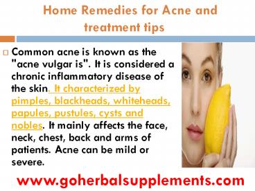 Home Remedies for Acne and treatment tips