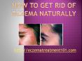 How to Get Rid of Eczema Naturally PowerPoint PPT Presentation