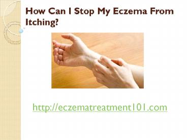How Can I Stop My Eczema From Itching