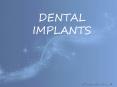 Information on Dental Implants PowerPoint PPT Presentation