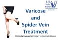 USA Vein Clinics PowerPoint PPT Presentation