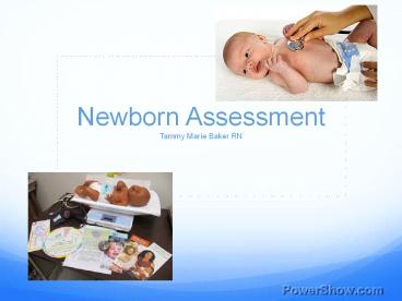 Newborn Assessment