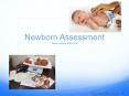 Newborn Assessment PowerPoint PPT Presentation