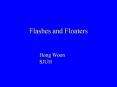 Flashes and Floaters Hong Woon SJUH Flashes and Floaters PowerPoint PPT Presentation