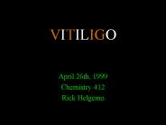 VITILIGO