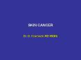 SKIN CANCER PowerPoint PPT Presentation