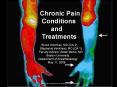 Chronic Pain Problems and Techniques PowerPoint PPT Presentation