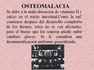 OSTEOMALACIA