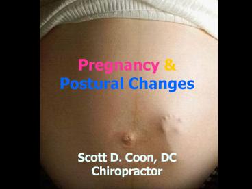 Pregnancy & Postural Changes