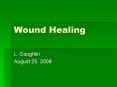 Wound Healing L. Coughlin August 25, 2008 Phases of Wound PowerPoint PPT Presentation