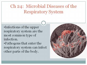 Ch 24: Microbial Diseases of the Respiratory System