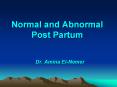 Normal and Abnormal Post Partum Dr. Amina El-Nemer Chapter PowerPoint PPT Presentation