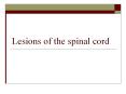 Lesions of the spinal cord PowerPoint PPT Presentation