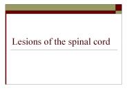 Lesions of the spinal cord
