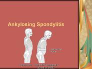 Ankylosing Spondylitis