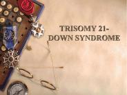 TRISOMY 21- DOWN SYNDROME