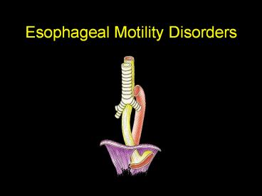 Esophageal Motility Disorders