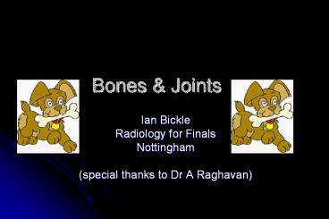 Bones & Joints