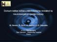 Dorsum sellae solitary plasmacytoma revealed by neuronavigation-guided biopsy PowerPoint PPT Presentation