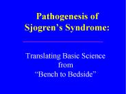 Pathogenesis of Sjogren