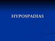 HYPOSPADIAS