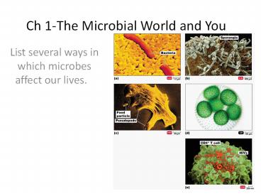 Ch 1-The Microbial World and You