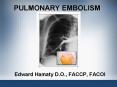 PULMONARY EMBOLISM Edward Hamaty D.O., FACCP, FACOI Primary PowerPoint PPT Presentation