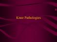 Knee Pathologies Alignment Pathologies General Knee PowerPoint PPT Presentation