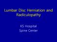 Lumbar Disc Herniation and Radiculopathy PowerPoint PPT Presentation