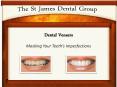 Dental Veneers: Cover your Teeth's Imperfections with Dental Veneers PowerPoint PPT Presentation