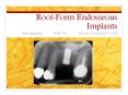 Root-Form Endosseous Implants PowerPoint PPT Presentation