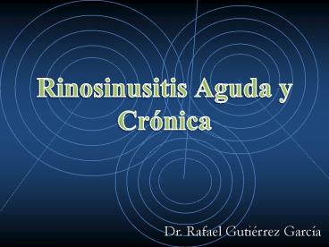 Rinosinusitis Aguda y Crуnica
