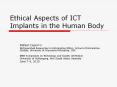 Ethical Aspects of ICT Implants in the Human Body PowerPoint PPT Presentation