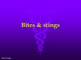 Bites & stings PowerPoint PPT Presentation