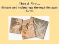 Then & Now… disease and technology through the ages Part II PowerPoint PPT Presentation