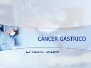 Gastric Cancer