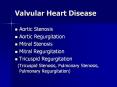 Valvular Heart Disease PowerPoint PPT Presentation