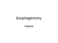 Esophagectomy Hashmi The choice of the appropriate technique PowerPoint PPT Presentation